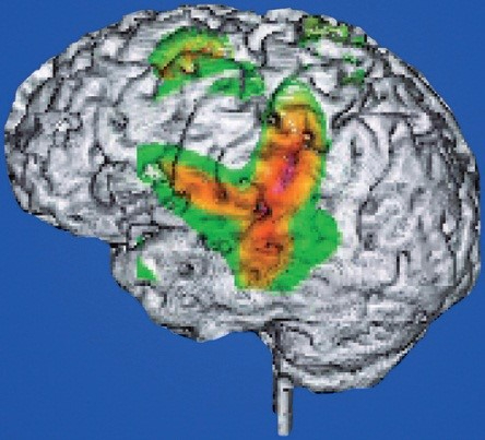 为什么能用核磁共振检查身体