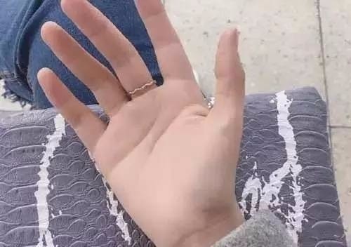 夏季出汗要注意 小心是中风前兆