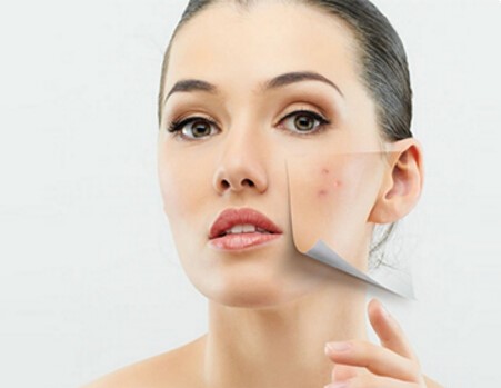 脸上长痘痘怎么去调理？