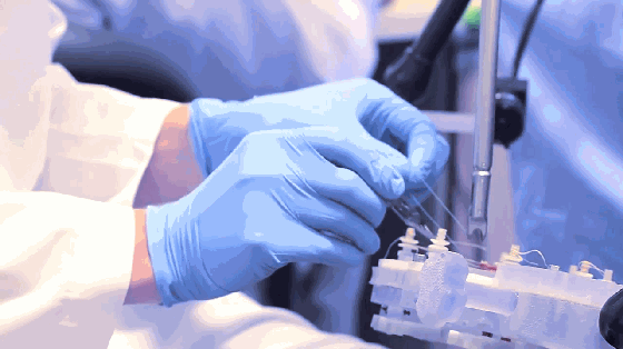 世界上最小的外科手术机器人 医生手术好帮手