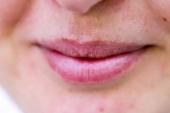 从嘴唇看你的五脏六腑，养出健康双唇！