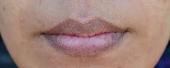 从嘴唇看你的五脏六腑，养出健康双唇！