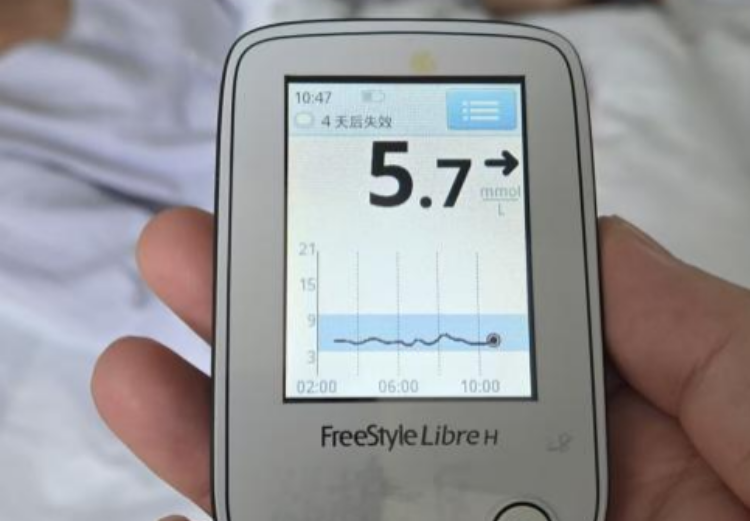 医学科普 | 胡安斌主委：与“脆性糖尿病”抗争，胰岛移植带来新希望！